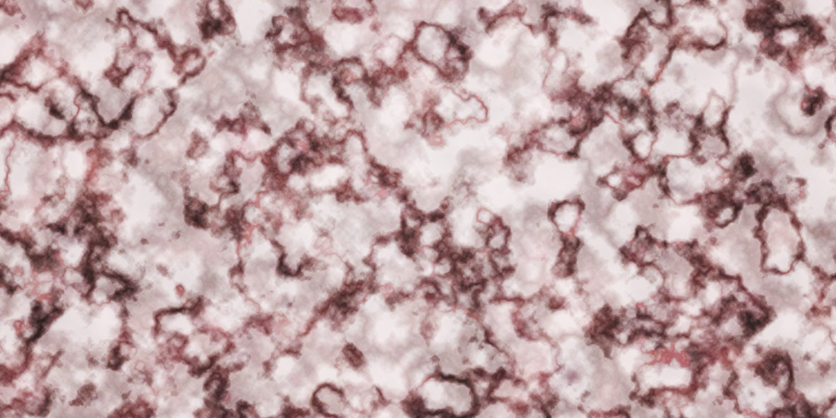 Understanding the Process and Benefits of Buying Pure Gold